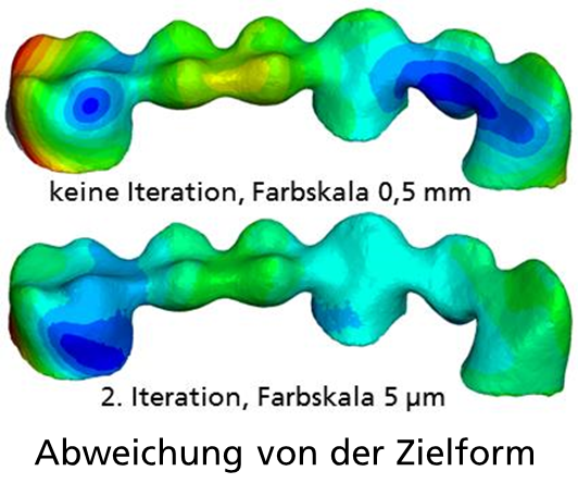 Calculation of the sintering distortion of a graded dental bridge